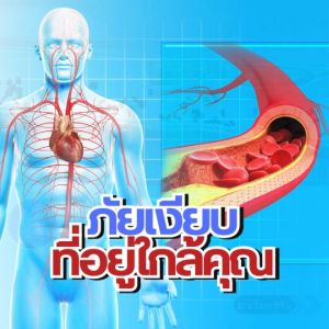 ไฟโตสเตอรอล กิฟฟารีน ไขมัน หัวใจ ความดัน Phytossterol giffarine 60 แคปซูล - ส่งฟรี