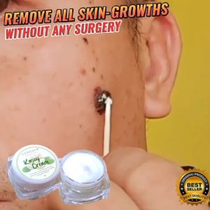 ⚡️ FLASH SALE: AUTHENTIC KASOY CREAM WART REMOVER & PAINLESS SKIN TAG TREATMENT