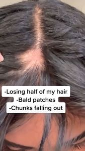 Lanthome Rice Water Hair Serum: Unlocking Naturally Thicker & Longer Hair