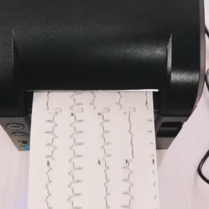 กระดาษสำหรับเครื่องตรวจคลื่น กระดาษสำหรับเครื่องตรวจคลื่นไฟฟ้าหัวใจ (paper for ecg) ยาว 110 มม