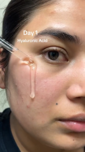 The Ordinary Hyaluronic Acid 2% + B5 Hyaluronic Acid Moisturizer Serum