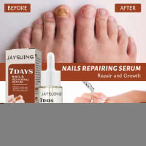 Ingrown Toenail Drops Soften Nail Fungal Treatment Feet Care Essence Anti Infection Paronychia Serum Hand Foot Care