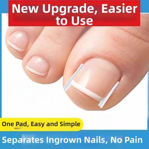 Jiaxun | Ingrown Toenail Corrector For Big Toe