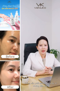 TINH CHẤT PHỤC HỒI B5 VENUKO CICA PANTHENOL AMPOULE 10% - 33ml