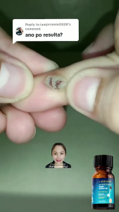 Krim Penjagaan Kulit Gentle skin care cream mild formula cares for rough skin on hands and feet easy to apply for daily body skin maintenance