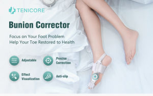 DEYU Adjustable Knob Bunion Corrector For Women And Men Big Toe Bunion Orthopedic Toe Straighteners Bunion Splint for Bunion Relief 1PC 拇外翻 拇囊炎 脚趾矫正器