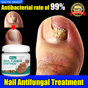 Fungal Nail Solution👌SOUTH MOON Nail repair cream nail treatment fungal ointment 20g for repair damaged nails， Effective Fungus Removal and Onychomycosis Nail care essence anti Fungal nail cream Nail repair serum gamot sa nasisirang kuko