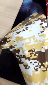 ครอบบังโคลนหน้า Honda Zoomer-X ปี 2012-2014 (สีเหลือง APK20A61100ZB / สีแดง APK20A61100ZD)