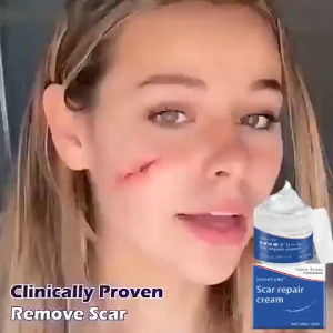 50g Scar Remover Cream From Japan Original Effective Peklat Remover Gel Repair Old Scars Fades Acne Whitening Scar Cream Anti-Stretch Mark Cream Scar Repair Cream old scars peklat remover legit pangtanggal pampatanggal ng peklat