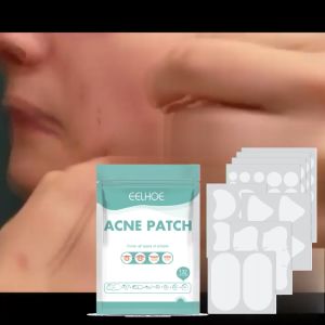 Masker Jerawat Lembut EELHOE 132PCS: Solusi Menghilangkan Bekas Jerawat