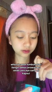 MASKER WAJAH SPIRULINA HQ MALAYSIA HALAL AMAN DAN MENJAGA JERAWAT DARI FLEK HITAM SELAMAT PAKE 1 BOTOL UNTUK 3 BULAN PENGGUNAAN