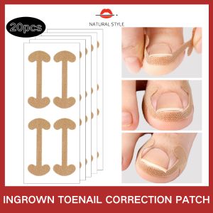 เครื่องแก้ไขเล็บ Paronychia แบบเล็บคุดแยกนิ้วแบบพิเศษผ้าพันแผลยืดหยุ่นแก้ไขเนื้อยาว