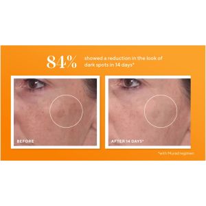MURAD Rapid Dark Spot Correcting Serum 30ml | Brightening Serum for Dark Spots & Pigmentation