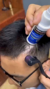 5% Minoxidil Extra Strength Topical Solution for Men | 6 Bottles with Dropper | Stimulates Follicles Reduces Baldness & Enhances Hair Density