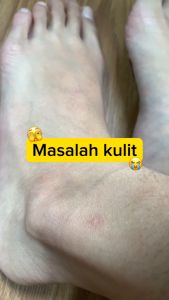 【2PCS!HEMAT】Cleora Calendula Healthy Bright Body Lotion – Handbody Wanita Pria With Niacinamide Brightening Memudarkan Bekas Luka Pereda Eksim Body Butter Skin Care Whitening Lotion Pemutih Seluruh Tubuh BPOM Kosmetik Penghilang Koreng Gelap Tangan Kaki