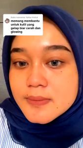 Amei Exfoliating Gel Wajah Dna Salmon Memudarkan Flek Hitam Dan Mengangkat Sel Kulit Mati ( amei official store )
