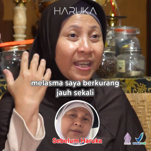 Paket Skincare Haruka untuk Kulit Flek