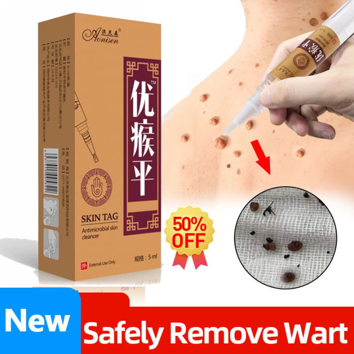 Wart Removal Serum Skin Tag Mole Remover Liquid Warts Treatment Foot