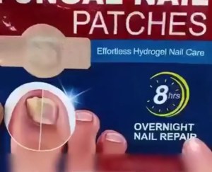 Best Seller FUNGAL NAIL PATCHES | Combats Infections Toe Nail | Renews Nail Structure | Fortifies Brittle Nails | Improves Nail Discoloration | Treats Fungal Infection | Strengthens Weak Nails | Overnight Nail Repair | Overnight Repair for Healthier Nails