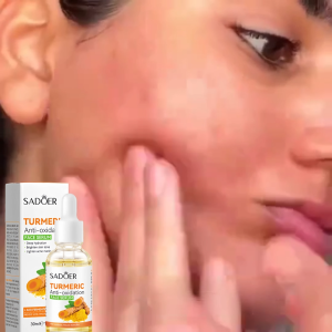 Turmeric Brightening Face Essence Serum Spot Lightening Whitening Essence Antioxidant Nourishing Moisturizing Repair Skin Skin Care Tools 30ml