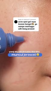 Emina Ms Pimple Acne Solution Spot Gel 15ml