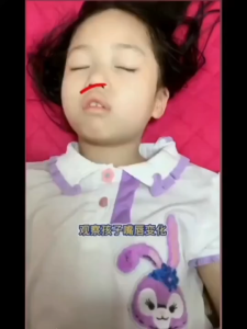 30PCS/BOX Mouth breathing correction patch children/adult closed mouth patch open mouth sleeping mouth closing patch