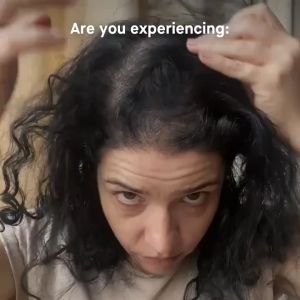 Anti Hair Loss Hair Treatment 60ml Polygonum Multiflorum Ginseng Root Plant Extraction Gentle Formula Say Goodbye To Baldhead Hair Loss Prevention  Nourish ＆ Strengthen Hair Root