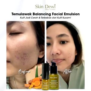 Skin Dewi Temulawak Balancing Facial Emulsion (Skincare Organic)