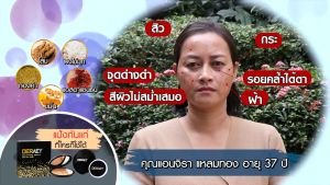 1 แถม 1 Deraey พร้อมส่ง แป้งเดอเอ้ แป้งกันแก่ DERAEY แป้งพัฟ ปกปิด ปกป้อง บำรุง ควบคุม ขนาด 18 กรัม