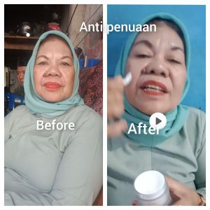 cream anti agine anti penuaan menghilanfkan kerutan dan memutihkan