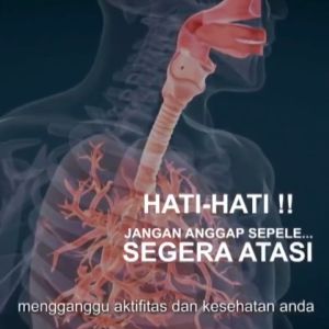LANCAR DAHAK!!! Obat Pelancar Dahak Obat Batuk Berdahak Yg Ampuh Sigurah Buang Lendir KAPSUL SIGURAH Sigurah Obat Paru Paru Kapsul SiGurah Asli Obat Herbal Peluruh Dahak Gurah Pernafasan Kapsul Ekstrak SI GURAH BPOM 60 Kapsul
