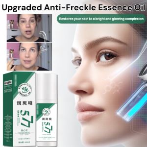 [Specially for stubborn spots] Upgraded Anti-Freckle Essence Oil Whitening Serum Fades Dark Spots Melasma Brightens Dull Skin