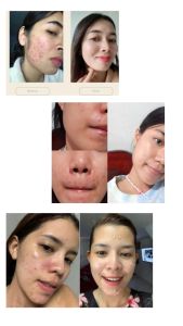 [ TERMURAH ] Aish Serum Korean Beauty Promo Spesial Serum Brightening/Acne/Darkspot Original BPOM Serum Aish Untuk Semua Masalah Kulitmu 15ml Glowing COD (BAYAR DITEMPAT) Official Aish Serum 1 Paket Original - Aish Serum korea n ORI Virak Tiktok Asli