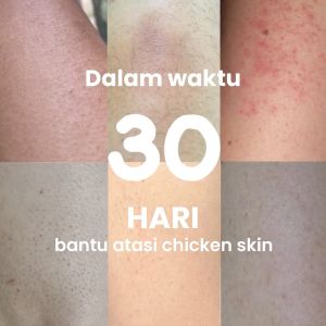 Rintik Skincare - No Bump Lotion / Lotion Tubuh Kulit Bruntusan & Chicken Skin 100ml