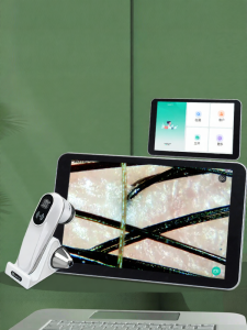 JUJIASHOU | Intelligent Scalp Inspection Device