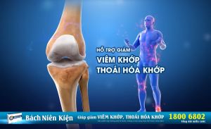 BÁCH NIÊN KIỆN - Giúp giảm viêm khớp thoái hóa khớp tăng khả năng vận động ở người bị bệnh xương khớp.