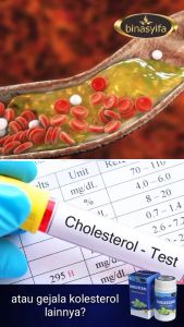 CHOLESCARE Obat Kolestrol Tinggi Ampuh Menurunkan Lemak Darah Mencegah Stroke Melancarkan Peredaran Darah Binasyifa Herbal