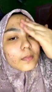 GLAMOIRE - ROSEMARY Acne Secret Serum | Serum Muka | Serum Wajah Anti Jerawat