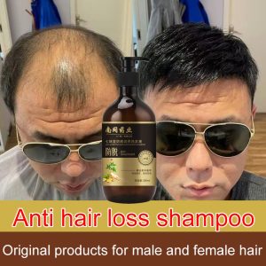 He Shou Wu Ginger Shampoo 300ml Chinese Herbal Anti-hair loss and hair growth Soothes the scalp Relieves itching oil Control and dandruff shampoo生姜育发液