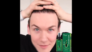 Hair Growth Spray & Hair Loss Treatment: Exploring Hair Growth Spray & Strong Hair Root Serum