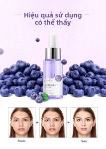 Laikou Blueberry Face Serum 17ml Chống Lão Hóa Trị Mụn & Xóa Nếp Nhăn Mặt Nâng Cơ Tinh Chất Làm Trắng Da Chăm Sóc Da Dành Cho Nữ