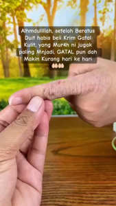 BaiYaoLang Cream Skin Care Ointment Treatment Psoriasis Eczema Dermatitis Fungal Infection Relieve Itchy Skin Repair Herbal Extract Ingredients Are Safe Non-irritating Cream Portable Original Buy 1 Take 1 Clear Heat And Detoxify Antibacterial Cream