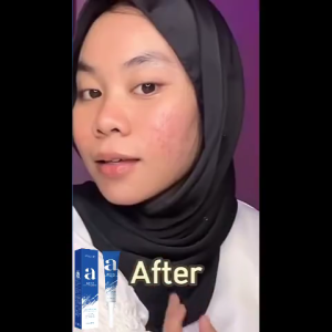 BHA&Sulfur Acne Spot Gel Acne Treatment Mengurangi Pori Tersumbat Mengontrol Sebum Bantu Pudarkan Bekas Jerawat Hitam