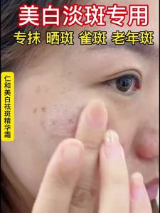 RENHEJIANGXIN | Pigment Deposition Removal Improving Uneven Skin Tone Cream