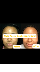 SOME BY MI Yuja Niacin Anti Blemish Starter Kit 4 Step Set | Paket Starter Pack | 4 Components