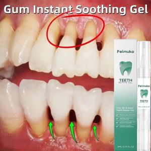 EELHOE | Damaged Gum Repair Care Gel Relieve Sore Gums Allergy Deep Cleaning Teeth Stains Tartar Serum Dental Caries Toothpaste