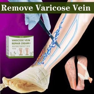 varicose veins cream original 50g vein repair cream alleviates earthwormlegs treatment of spider veins leg care  Promote blood circulation