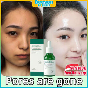 ⭐️SG STOCK⭐️ Salicylic acid pore minimizer serum / Acne spot treatment / Repair acne marks / Pore serum / Pore tightening serum