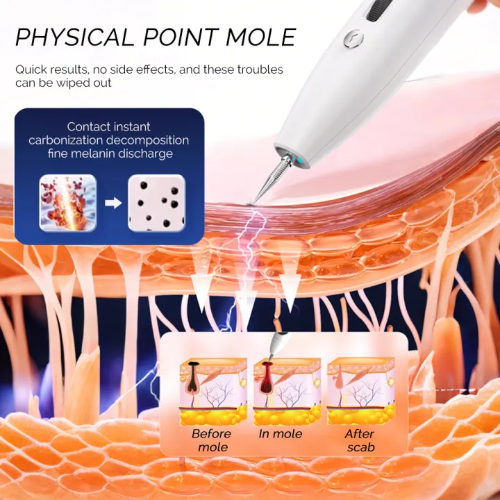 36%20Levels%20Dual%20Needles%20Mole%20Removal%20Pen%20Freckle%20Dark%20Spot%20Tattoo%20Remover%20Skin%20Tag%20Warts%20Fleshy%20Nevus%20Cleaner%20Plasma%20Laser%20Pen%20-%20Image%203