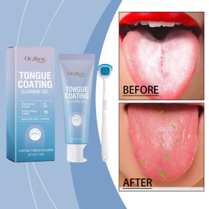 oralhoe | Tongue Cleansing Gel Deep Clean Tongue Coating Remove Bad Breath Long Lasting Fresh Breath Daily Oral Care Gel